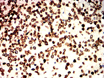 LMNB1 Mouse mAb[63874]