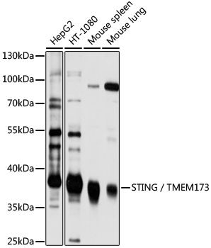 STING / TMEM173 Rabbit Polyclo