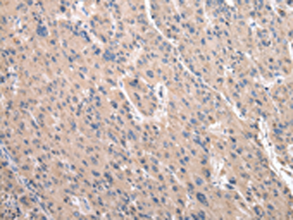 RPS10 Antibody[43045]