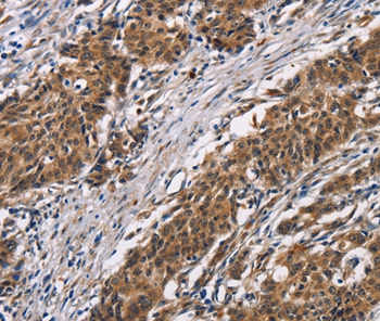 ARSB Antibody[37428]