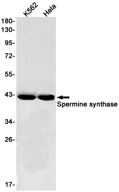 Spermine Synthase Rabbit mAb[5