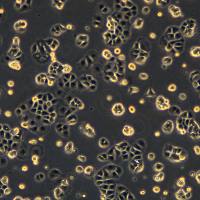 浙江(杭州)美森 人卵巢癌腺癌细胞 OVCAR-3