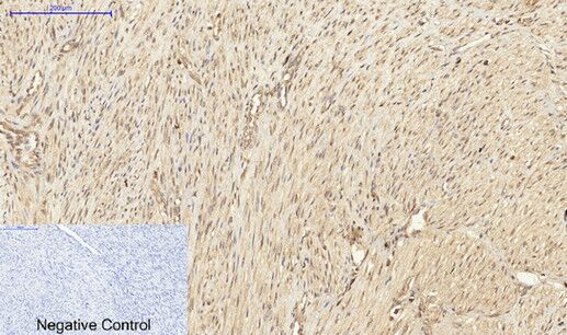 PKC Polyclonal Antibody[41347]