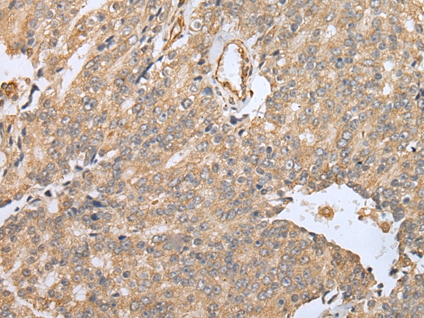 EBI3 Antibody[42991]
