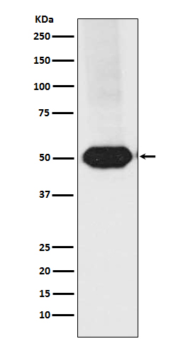 MEF2A+MEF2C Rabbit mAb[56176]