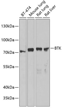 BTK Rabbit Polyclonal Antibody