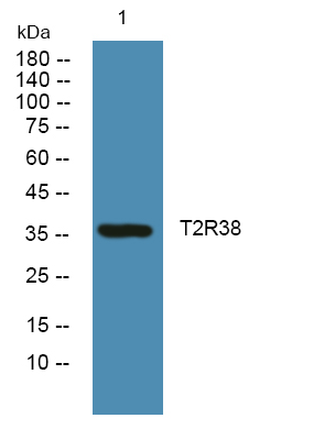 TAS2R38 Antibody[44623]