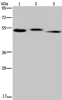 HYAL3 Antibody[36540]