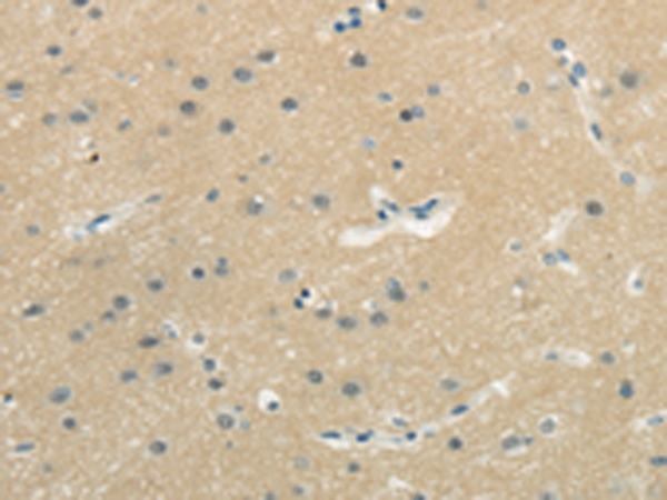 WASF3 Antibody[43182]