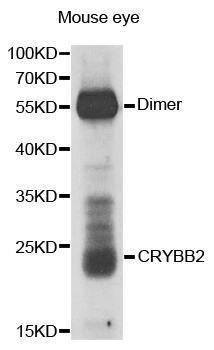 CRYBB2 antibody[38669]