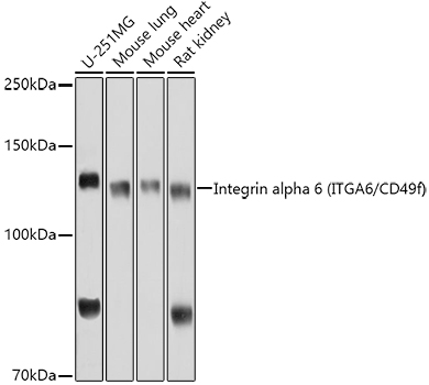 ITGA6 Rabbit Polyclonal Antibo