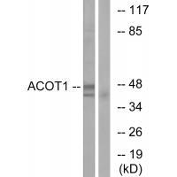 ACOT1 Antibody[34379]