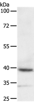 DTX3 Antibody[35712]