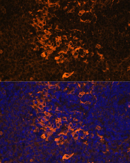 IL1 beta Rabbit Polyclonal Ant