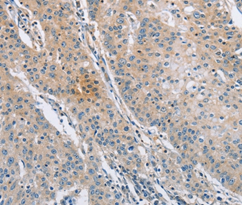 SH3GLB1 Antibody[36281]