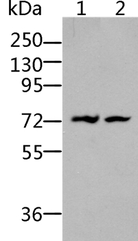 BDKRB2 Antibody[36766]