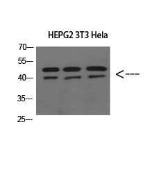 ERLIN1/2 Polyclonal Antibody[4
