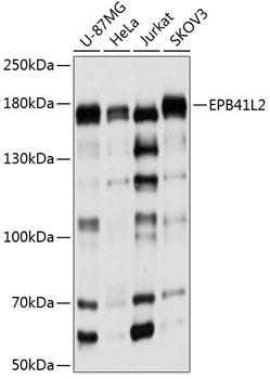 EPB41L2 Rabbit Polyclonal Anti