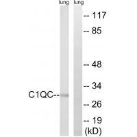 C1QC Antibody[34608]