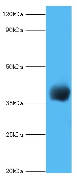 cpg2 Polyclonal Antibody[42637