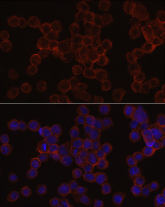 IRAK4 antibody[38750]
