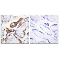 PHLA2 Antibody[33924]