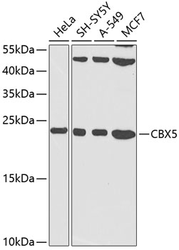 CBX5 Rabbit Polyclonal Antibod