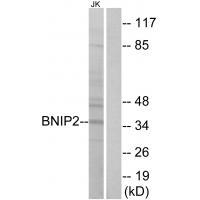 BNIP2 Antibody[34480]