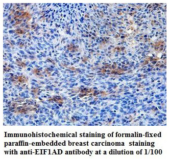 EIF1AD Antibody[39819]