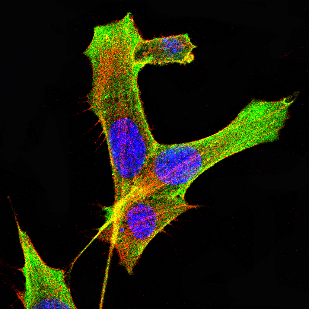 IL-2 Mouse mAb[63781]