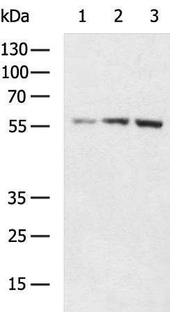 SLC2A6 Antibody[43276]