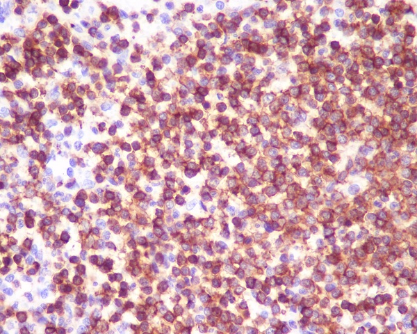 CD45 Rabbit mAb[56054]