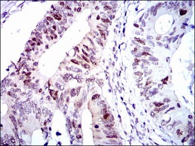 CDK2 Mouse mAb[63446]