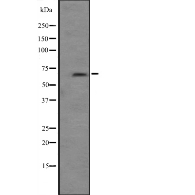 PRKCI Antibody[44888]