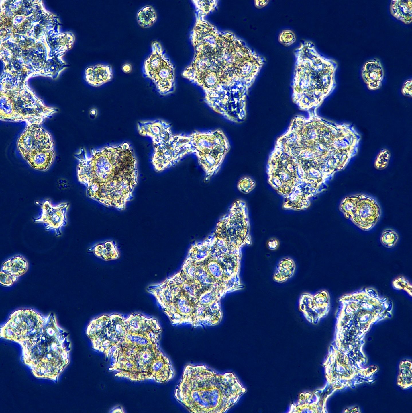 浙江（杭州）美森 人食管癌细胞 OE19