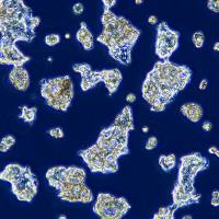 浙江(杭州)美森 人食管癌细胞 OE19