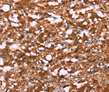 BRK1 Antibody[37618]