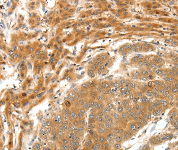 SERPINE1 Antibody[35861]