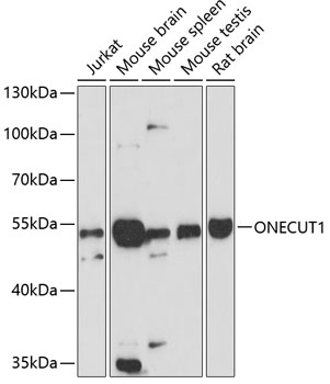ONECUT1 Polyclonal Antibody[27