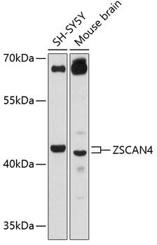 ZSCAN4 Polyclonal Antibody[275