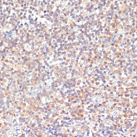 PRKCD Polyclonal Antibody[2904