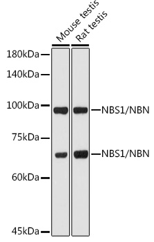 NBN Polyclonal Antibody[27241]
