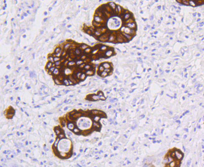Cytokeratin 19 Rabbit mAb[4862