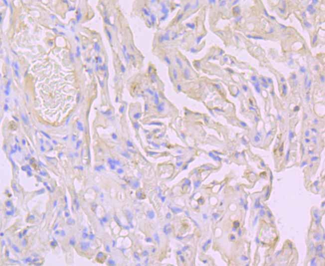 Flotillin 1 Rabbit mAb[49861]