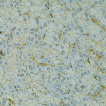 KCNJ1 Polyclonal Antibody[3159