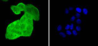 HSPA4 Rabbit mAb[49198]