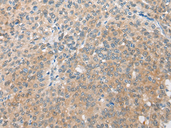 CBR3 Antibody[46412]