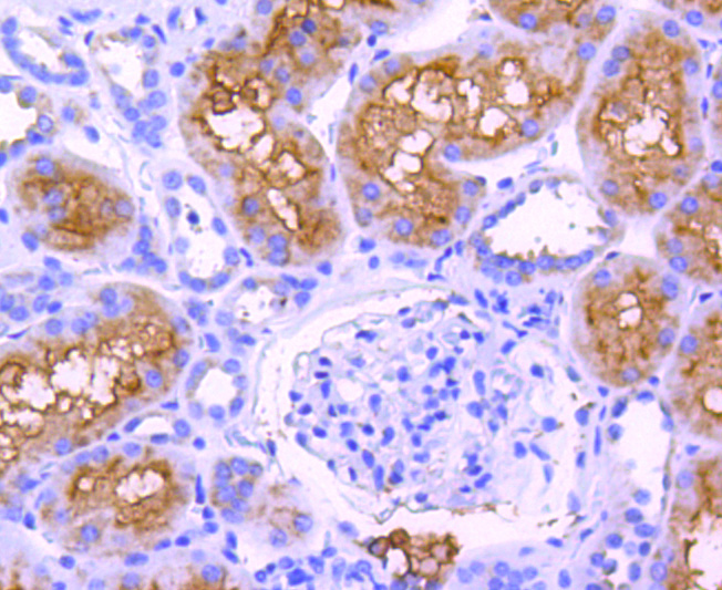 ABCF1 Rabbit mAb[49078]