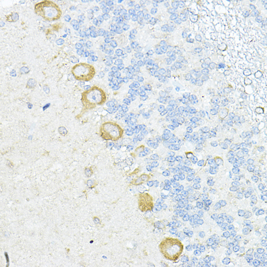 RPL10A Polyclonal Antibody[306