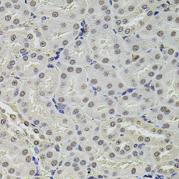 SET Polyclonal Antibody[29117]
